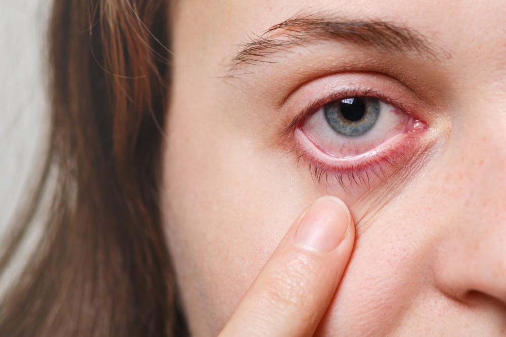 Read more about the article Black Fungus in Eyes Symptoms and Prevention