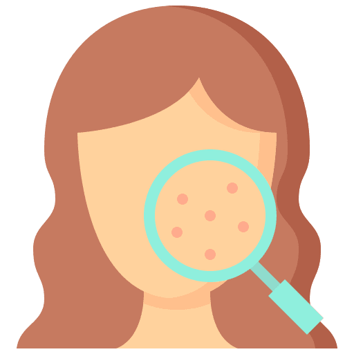acne skin treatment in hulsoor