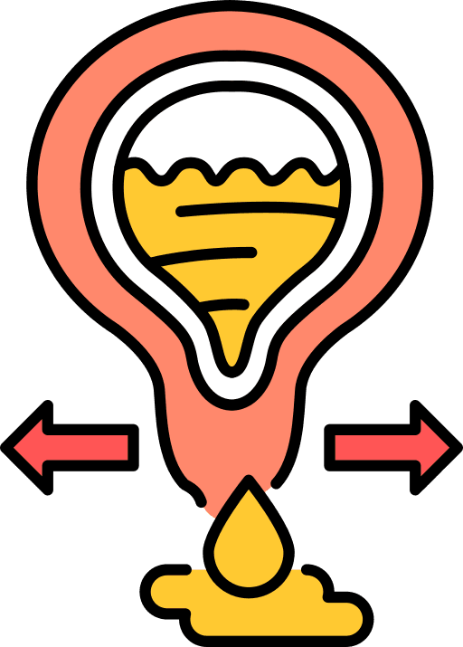 urinary incontinence